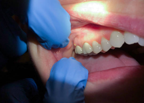 Best Emergency Treatment for Toothache in Harrison, NJ